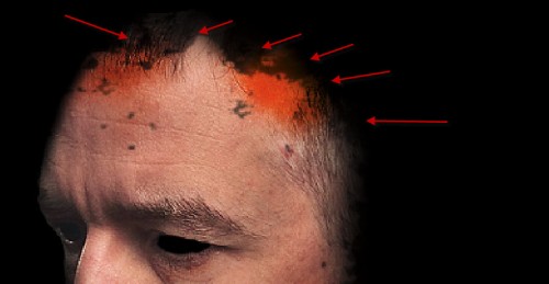 2 eraser 500x259 Design an Interesting Human Face Manipulation with Tree Roots Texture in Photoshop